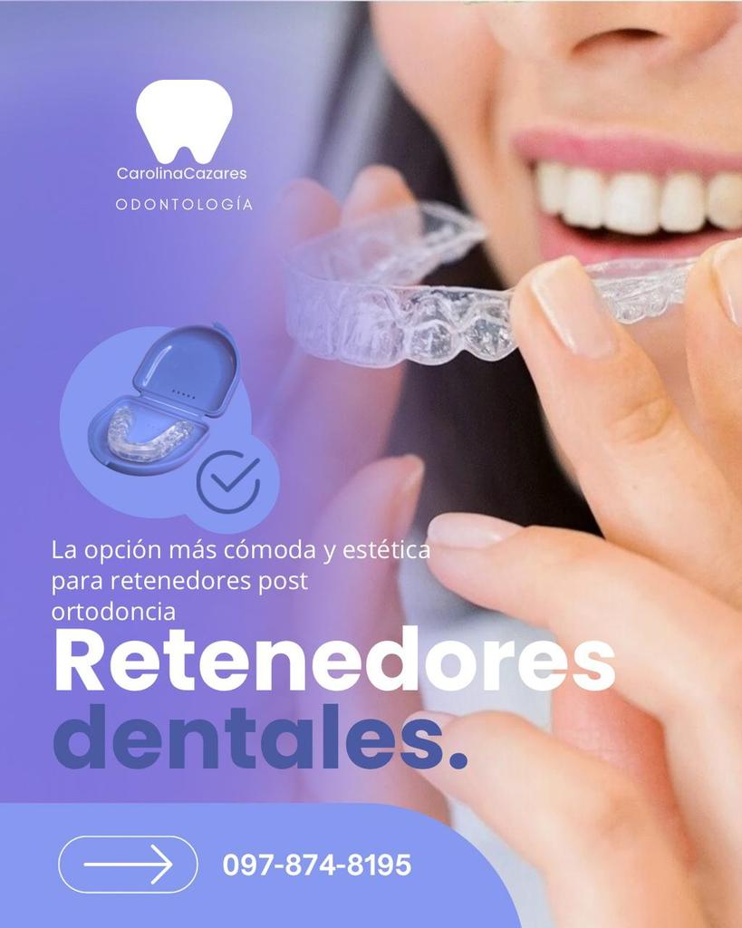 Guía sobre retenedores transparentes post ortodoncia