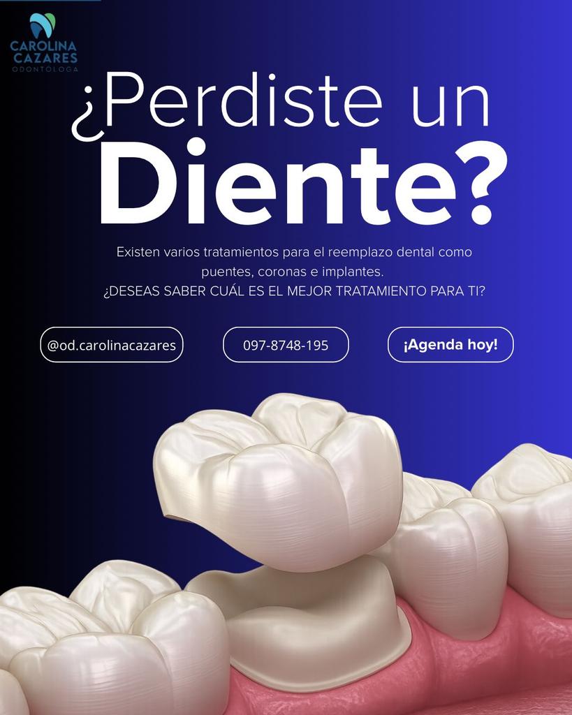 Implantes dentales — opciones y costos